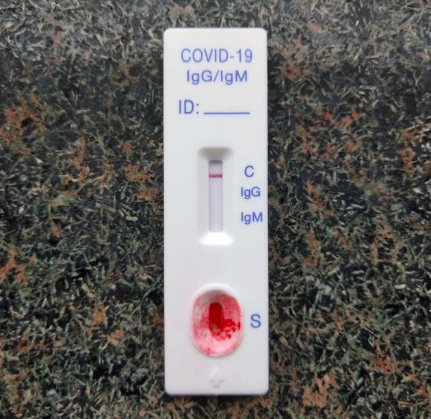 COVID 19 Antigen Rapid Test Cassette
