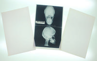 Medical x-ray film