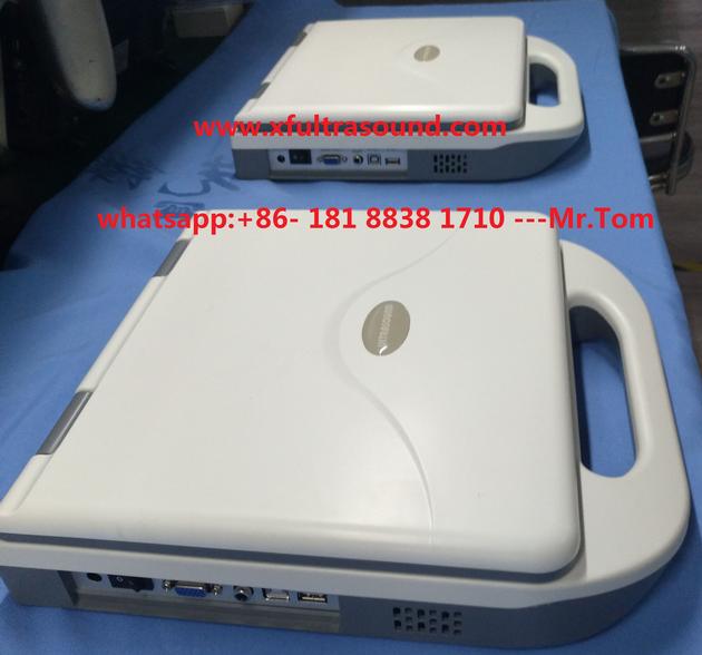 B Amp W Laptop Ultrasound Scanner