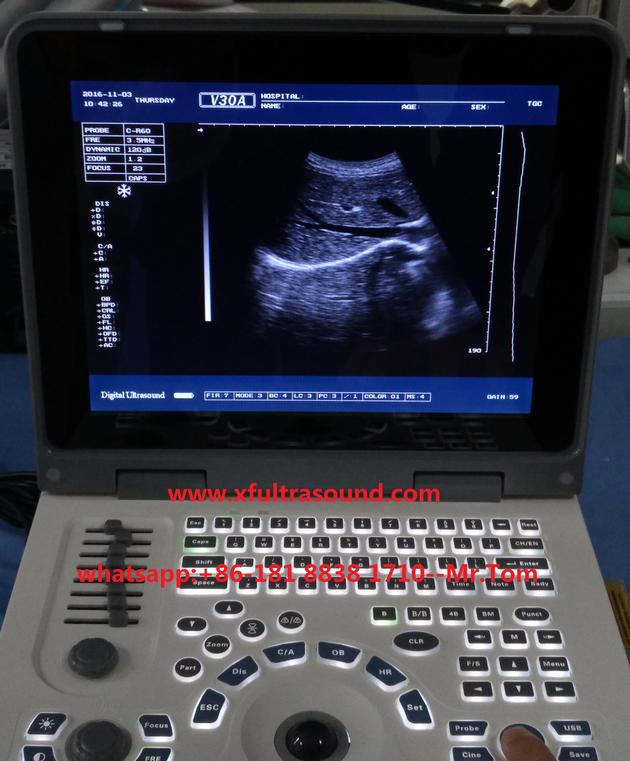 B Amp W Laptop Ultrasound Scanner