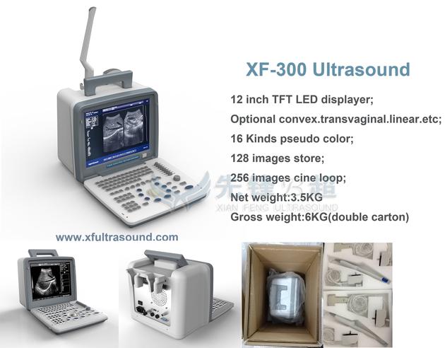 B Amp W Portable Ultrasound Scanner
