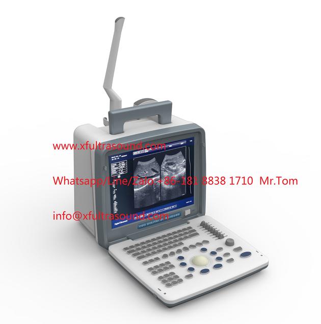 B&W Portable Ultrasound Scanner XF300 LED