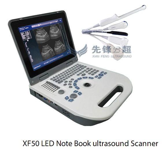 B&W Laptop Ultrasound Scanner XF50 LCD