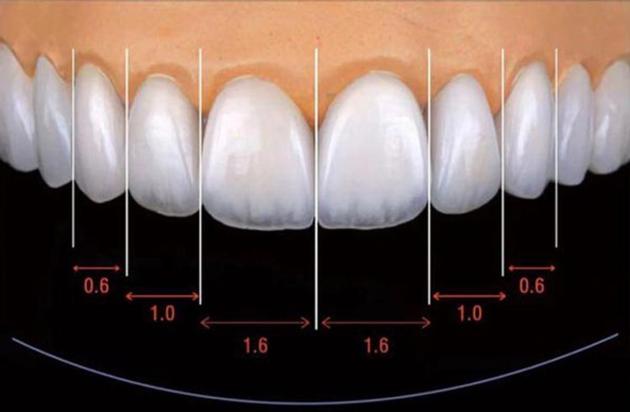 Dental Porcelain Veneer From China Dental