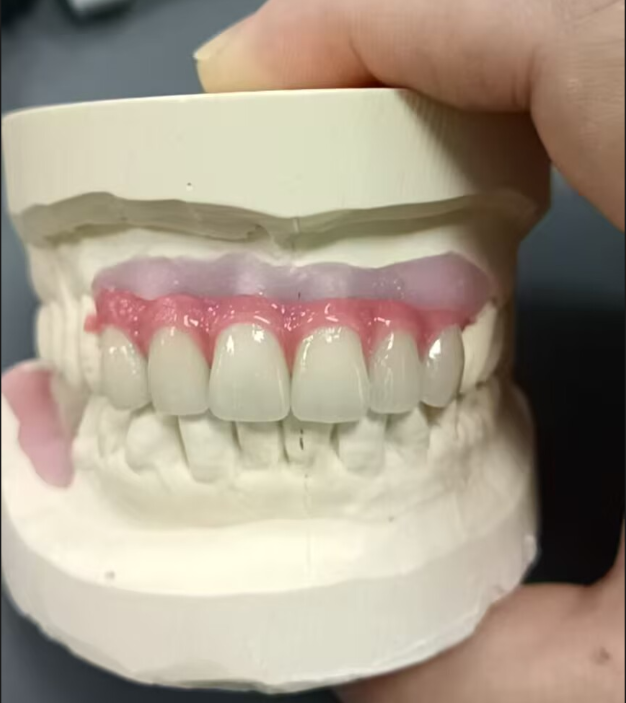China Dental Screwed Denture Manufacturers Suppliers