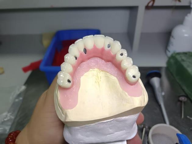 China all-on -x zirconia bridge manufacturers, suppliers, factory 