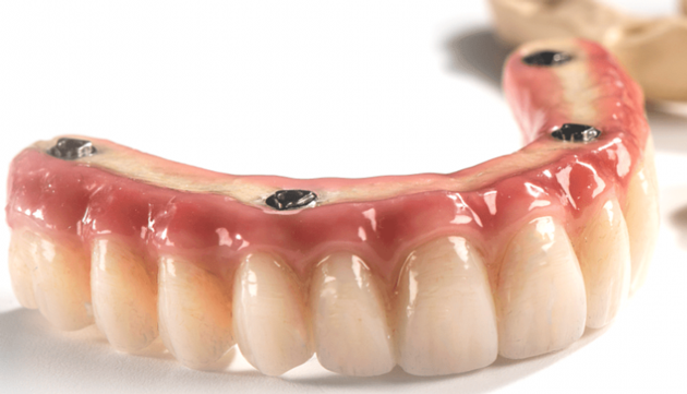 Dental Lab China Dental Laboratory China