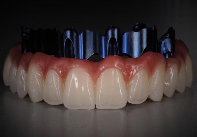 China Dental Lab Dental Lab Outsourcing
