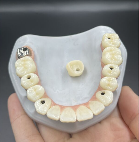 China Dental Screwed Denture Manufacturers Suppliers