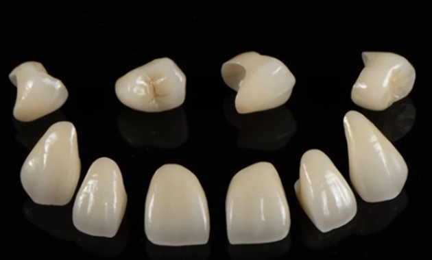 Dental Lab China Dental Laboratory China