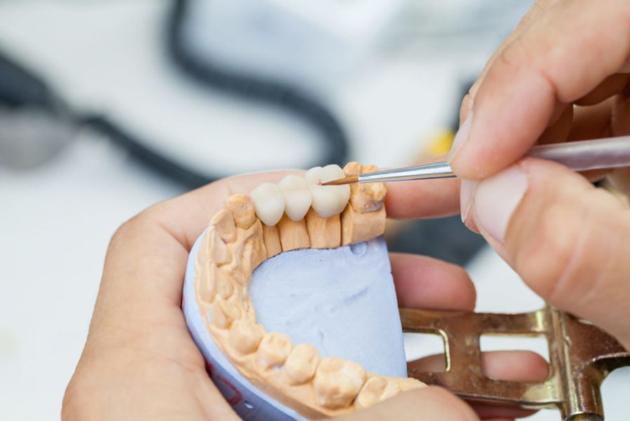 Dental Porcelain Veneer From China Dental