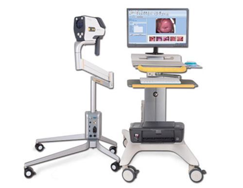 YKD-3001 Full HD Digital Video Colposcope