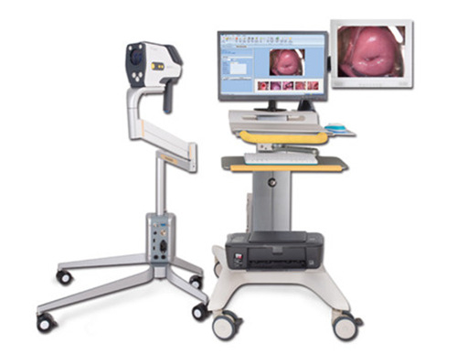 YKD-3002 HD Digital Electronic Colposcope
