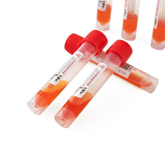 Virus Sample Tube Bennettpan At Foxmailcom