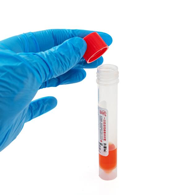 Virus Sample Tube Bennettpan At Foxmailcom