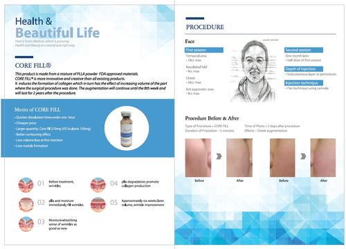 Corefill
