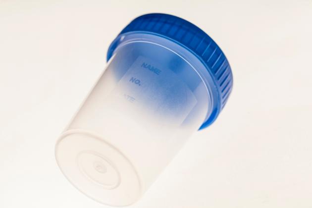 Urine Bottle