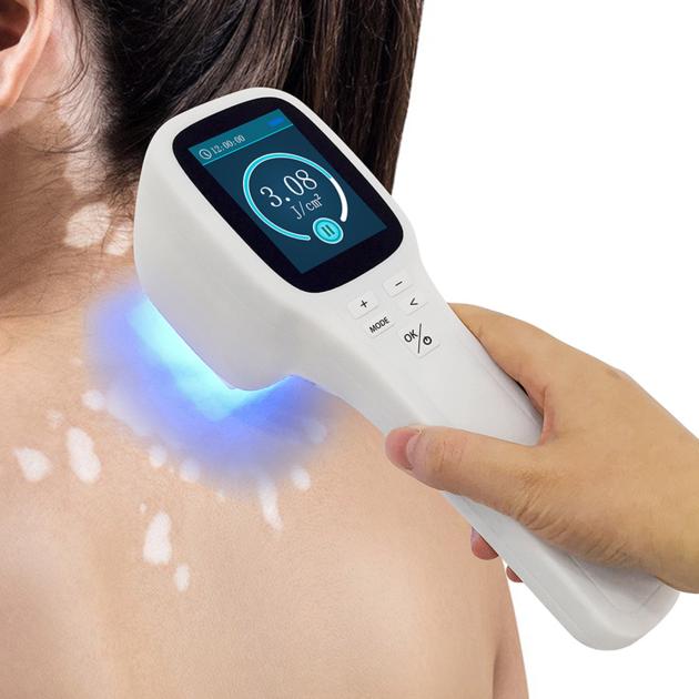 Popular Excimer Laser 308 Nm Uvb