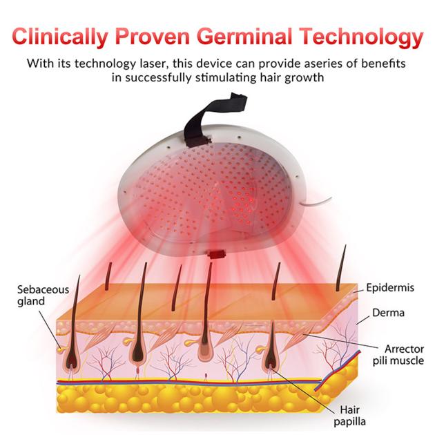 High Efficacy Laser Therapy Helmet For