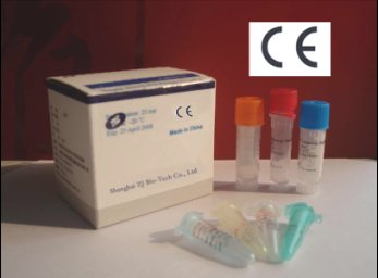 Avian H5N1 Real Time RT-PCR Kit